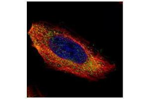 ICC/IF Image Confocal immunofluorescence analysis (Olympus FV10i) of paraformaldehyde-fixed HeLa, using MEK1, antibody (Green) at 1:200 dilution. (MEK1 抗体)