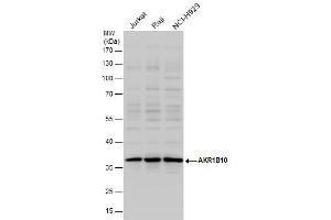 WB Image AKR1B10 antibody detects AKR1B10 protein by western blot analysis.