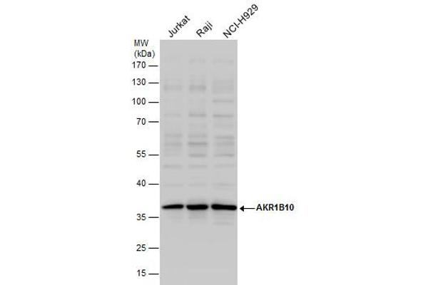 AKR1B10 抗体
