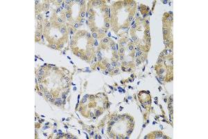 Immunohistochemistry of paraffin-embedded human gastric using MRPS22 antibody at dilution of 1:100 (x40 lens). (MRPS22 抗体)
