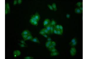 Immunofluorescence staining of HepG2 cells with ABIN7156735 at 1:133, counter-stained with DAPI. (IL1RAPL1 抗体  (AA 564-679))