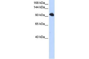 WB Suggested Anti-SFRS8 Antibody Titration:  0. (SFRS8 抗体  (N-Term))