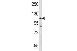 Lats2 antibody western blot analysis in mouse testis tissue lysate. (LATS2 抗体  (AA 1000-1027))