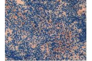 IHC-P analysis of Mouse Spleen Tissue, with DAB staining. (PARP1 抗体  (AA 661-881))