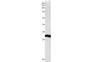 Western Blotting (WB) image for anti-Dual Specificity Phosphatase 6 (DUSP6) antibody (ABIN2421546) (DUSP6 抗体)