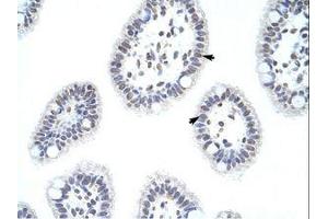 Image no. 1 for anti-Heterogeneous Nuclear Ribonucleoprotein D (HNRNPD) (AA 61-110) antibody (ABIN203267) (HNRNPD/AUF1 抗体  (AA 61-110))