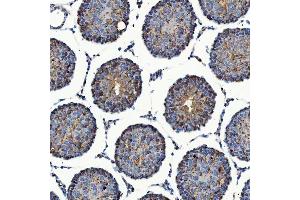 IHC analysis of SEC23IP using anti-SEC23IP antibody (ABIN7601222).