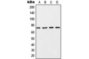 Western blot analysis of Collagen 8 alpha 1 expression in MDA-MB453 (A), A549 (B), SP2/0 (C), PC12 (D) whole cell lysates. (COL8A1 抗体  (Center))