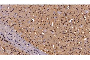 Immunohistochemistry (IHC) image for anti-Chromobox Homolog 3 (CBX3) (AA 1-183) antibody (ABIN7434851)