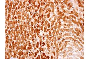 IHC-P Image HACL1 antibody detects HACL1 protein at cytosol on human normal liver by immunohistochemical analysis.