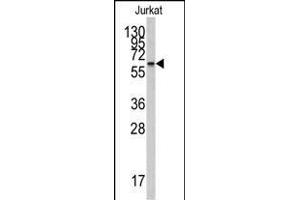 Western blot analysis of anti-CYP26A1 Antibody (Center) (ABIN389234 and ABIN2837922) in Jurkat cell line lysates (35 μg/lane). (CYP26A1 抗体  (AA 118-147))