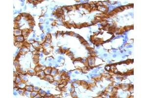IHC testing of FFPE mouse kidney tissue with recombinant Cadherin 16 antibody (clone KSCP2-2R). (Cadherin-16 抗体)