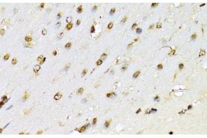 Immunohistochemistry of paraffin-embedded Mouse brain using RUNX1 Polyclonal Antibody at dilution of 1:100 (40x lens).
