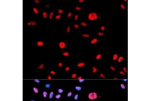 Immunofluorescence analysis of U2OS cells using Phospho-MDM2(S166) Polyclonal Antibody (MDM2 抗体  (pSer166))