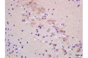 Formalin-fixed and paraffin embedded rat brain labeled with Rabbit Anti ChRM2 Polyclonal Antibody, Unconjugated (ABIN668646) at 1:200 followed by conjugation to the secondary antibody and DAB staining (Muscarinic Acetylcholine Receptor M2 抗体  (AA 168-250))