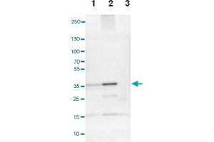 Western blot analysis of Lane 1: NIH-3T3 cell lysate (Mouse embryonic fibroblast cells), Lane 2: NBT-II cell lysate (Rat Wistar bladder tumour cells), Lane 3: PC12 cell lysate (Pheochromocytoma of rat adrenal medulla) with CREM polyclonal antibody. (CREM 抗体)