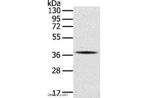 Western blot analysis of A375 cell, using SPARC Polyclonal Antibody at dilution of 1:400 (SPARC 抗体)