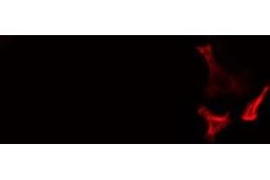 ABIN6278582 staining  LOVO cells by IF/ICC. (CABLES1 抗体  (C-Term))