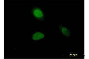 Immunofluorescence of purified MaxPab antibody to HIST1H1A on HeLa cell. (Histone H1.1 抗体  (AA 1-215))