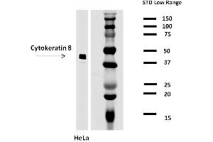 Detection of cytokeratin 8 in HeLa cell lysate (reducing conditions) by mouse monoclonal antibody C-43.
