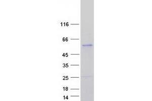 Western Blotting (WB) image for Casein Kinase 1, gamma 3 (CSNK1G3) (Transcript Variant 1) protein (Myc-DYKDDDDK Tag) (ABIN2712582)