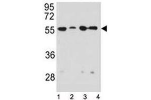 Vimentin antibody western blot analysis in 1) HeLa, 2) U251, 3) A549, and 4) MDA-MB231 lysate (Vimentin 抗体)