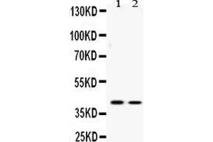 Western Blotting (WB) image for anti-Activating Transcription Factor 4 (Tax-Responsive Enhancer Element B67) (ATF4) (AA 71-100), (N-Term) antibody (ABIN4886477)