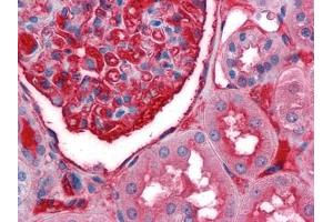 Immunohistochemical analysis of paraffin-embedded human Kidney tissues using anti-A1BG antibody (A1BG 抗体)