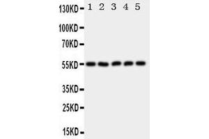 Western Blotting (WB) image for anti-Hyaluronidase-2 (HYAL2) (AA 142-157), (C-Term) antibody (ABIN3043041) (HYAL2 抗体  (C-Term))