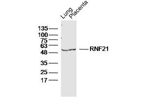 Lane 1: Mouse Lung lysates Lane 2: Mouse Placenta lysates probed with RNF21 Polyclonal Antibody, Unconjugated  at 1:300 dilution and 4˚C overnight incubation. (Protein RNF21 抗体)