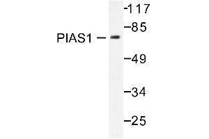 Image no. 1 for anti-Protein Inhibitor of Activated STAT, 1 (PIAS1) antibody (ABIN271951) (PIAS1 抗体)