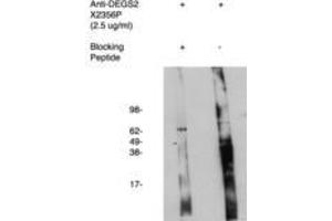 Image no. 1 for anti-Degenerative Spermatocyte Homolog 2, Lipid Desaturase (DEGS2) antibody (ABIN793718) (DEGS2 抗体)