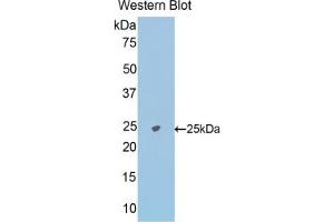 Detection of Recombinant NAGa, Mouse using Polyclonal Antibody to N-Acetylgalactosaminidase Alpha (NAGa) (NAGA 抗体  (AA 18-217))