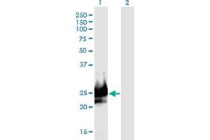 Western Blot analysis of DSCR6 expression in transfected 293T cell line by DSCR6 monoclonal antibody (M09), clone 1D1.