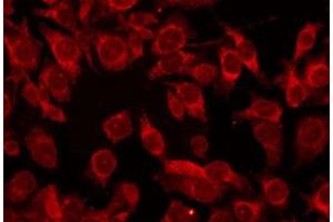 Immunofluorescence (fixed cells) (IF/ICC) image for anti-Collagen, Type XVII, alpha 1 (COL17A1) (N-Term) antibody (ABIN6260957)