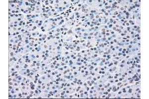 Image no. 5 for anti-Checkpoint Kinase 2 (CHEK2) antibody (ABIN1497497)