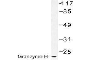 Western blot (WB) analysis of Granzyme H antibody in extracts from K562 cells. (GZMH 抗体)