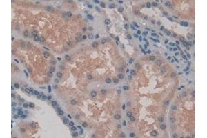 Immunohistochemistry (IHC) image for anti-Protease, serine, 1 (Trypsin 1) (PRSS1) (AA 51-228) antibody (ABIN7431413)
