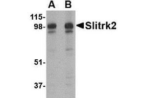 Western blot analysis of Slitrk2 in rat brain tissue lysate with Slitrk2 antibody at (A) 1 and (B) 2 µg/ml. (SLITRK2 抗体  (C-Term))