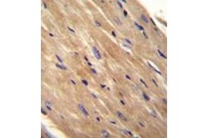Formalin fixed, paraffin embedded Mouse heart tissue stained with RhoJ Antibody  followed by peroxidase conjugation of the secondary antibody and DAB staining. (RHOJ 抗体  (Middle Region))