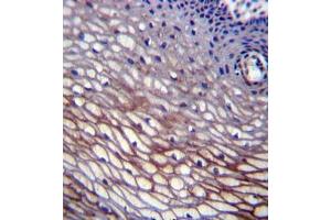 Formalin fixed, paraffin embedded human cervix tissue stained with SKA2 Antibody (N-term) followed by peroxidase conjugation of the secondary antibody and DAB staining. (FAM33A 抗体  (N-Term))