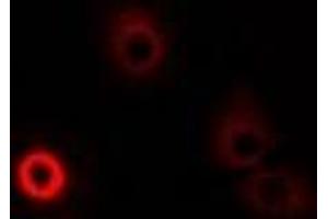 Immunofluorescent analysis of DAO staining in MCF7 cells. (D Amino Acid Oxidase 抗体)