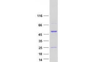 Validation with Western Blot (RCC1 Protein (Transcript Variant 3) (Myc-DYKDDDDK Tag))