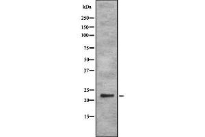 Western blot analysis of RAB35 using K562 whole cell lysates
