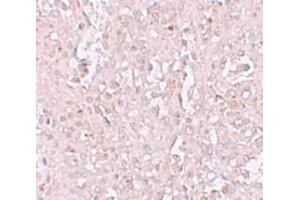 Immunohistochemistry (IHC) image for anti-Solute Carrier Family 39 (Zinc Transporter), Member 13 (SLC39A13) (N-Term) antibody (ABIN1031681) (SLC39A13 抗体  (N-Term))