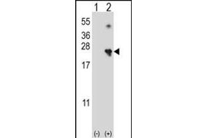 Western blot analysis of NME4 (arrow) using rabbit polyclonal NME4 Antibody (M1) (ABIN392784 and ABIN2842222). (NME4 抗体  (N-Term))