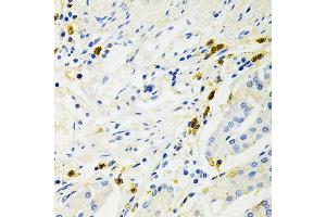 Immunohistochemistry of paraffin-embedded human stomach using NF-kB p65/RelA Antibody (ABIN3016234, ABIN3016235, ABIN3016236 and ABIN6219643) at dilution of 1:200 (40x lens). (NF-kB p65 抗体  (AA 50-180))