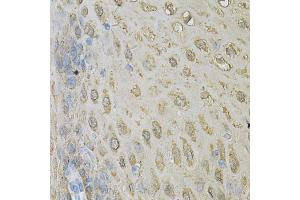 Immunohistochemistry of paraffin-embedded human esophagus using ALDH3A1 Antibody. (ALDH3A1 抗体)