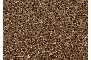 ABIN6272847 at 1/100 staining Rat liver tissue by IHC-P. (Sestrin 2 抗体)