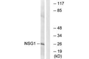 Western blot analysis of extracts from COLO cells, using NSG1 Antibody. (NSG1 抗体  (AA 112-161))